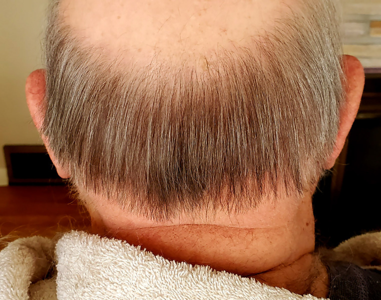Ken Steinhoff COVID hairdo 09-18-2020