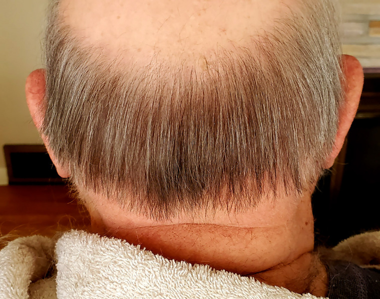 Ken Steinhoff COVID hairdo 09-18-2020